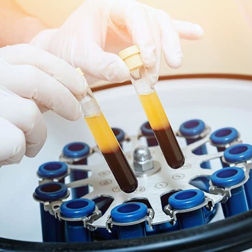 Utilisation de concentrés plaquettaires